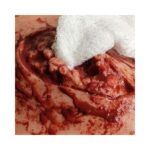 svtac-gasa-comprimida-plegada-en-z-de-quick-response (2)